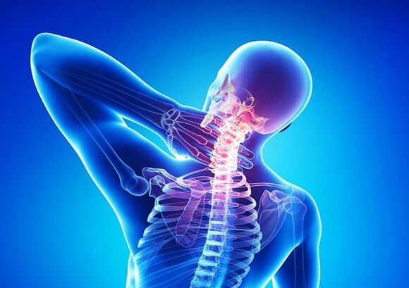 Dor na columna cervical con osteocondrose