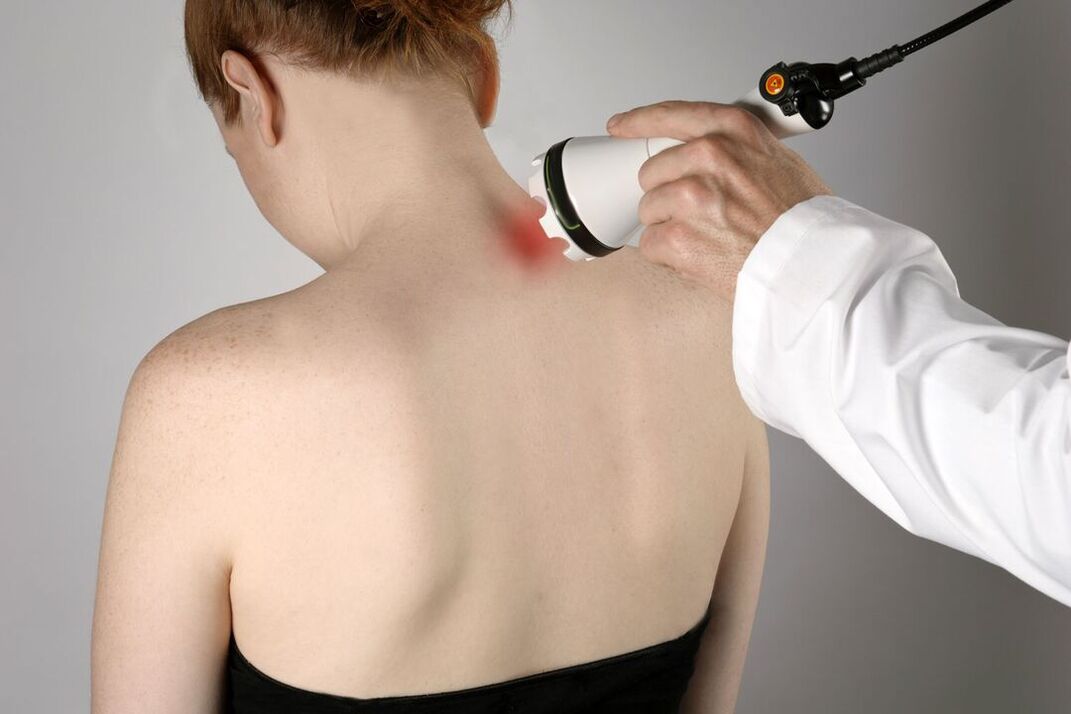 Tratamento fisioterapéutico da osteocondrose cervical