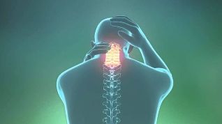 osteocondrose da cervical
