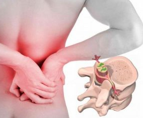 Lumbago no inicio da enfermidade osteocondrose