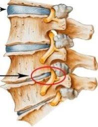 Osteocondrose da columna cervical